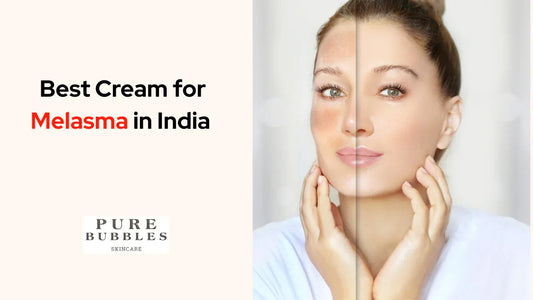 Before and after melasma treatment with brightening skincare cream for even skin tone