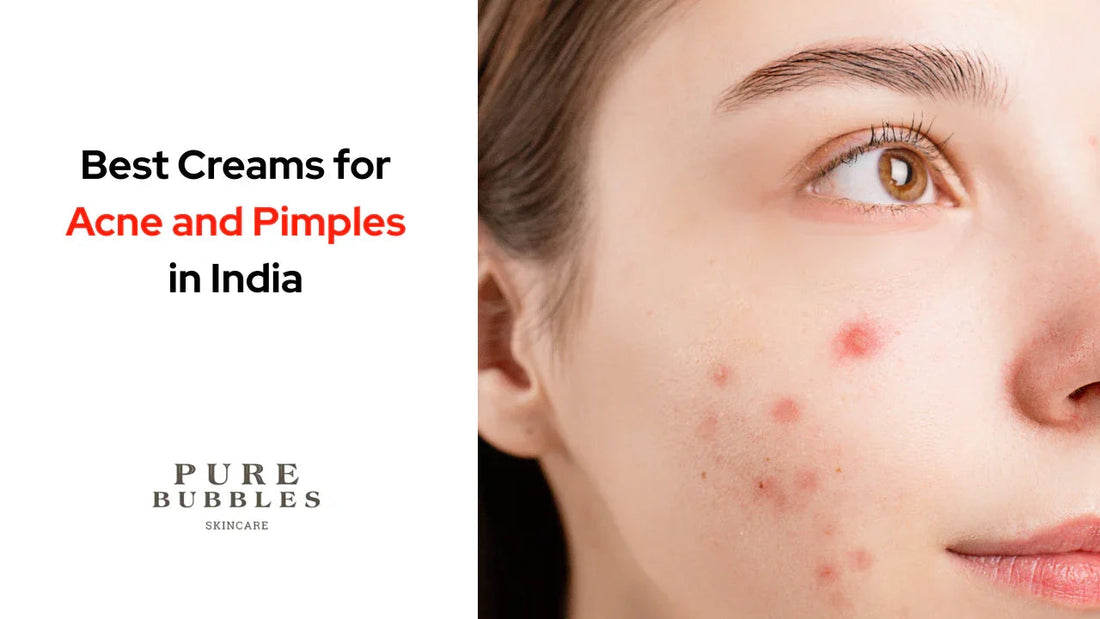 Best creams for acne and pimples in India, featuring clear skin solutions with retinol and plant-based actives.