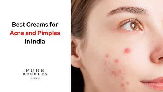 Best creams for acne and pimples in India — clear skin solutions with retinol and plant-based actives