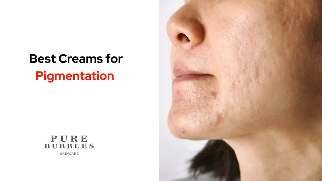 Best creams for pigmentation and acne scars, featuring clean skincare solutions for sensitive skin
