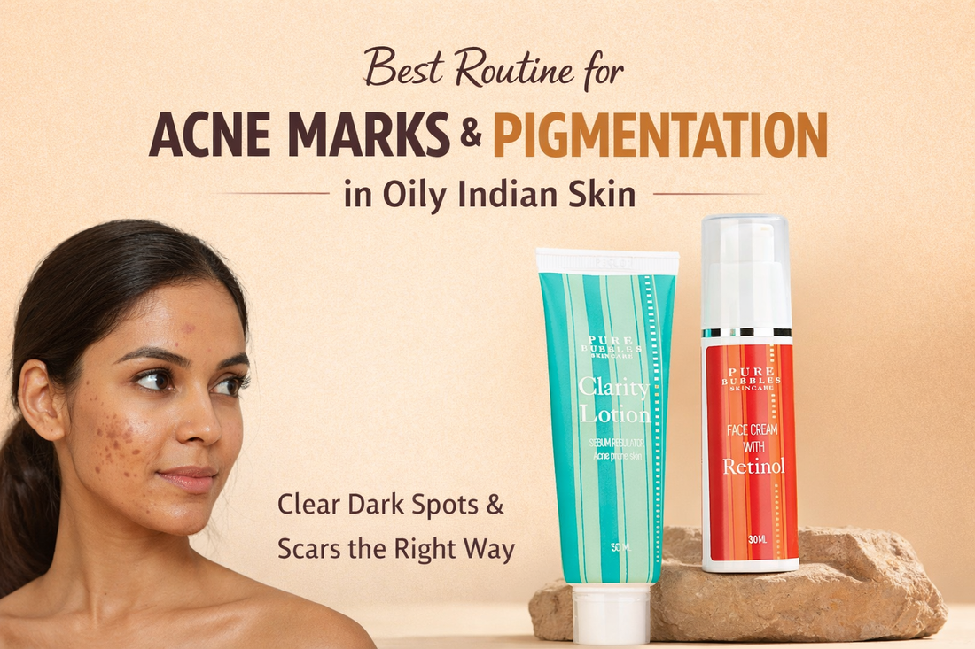 Skincare routine for acne marks & pigmentation on oily Indian skin with retinol face cream and clarity lotion