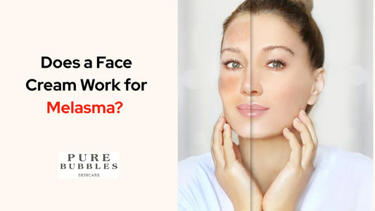 Before and after face cream results for melasma, showing clearer skin tone