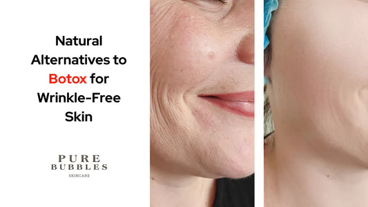 Before and after skincare results showing wrinkle-free skin with natural alternatives to Botox