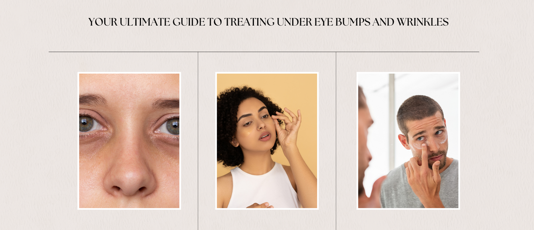 Your Ultimate Guide to Treating Under Eye Bumps and Wrinkles - Pure Bubbles Skincare