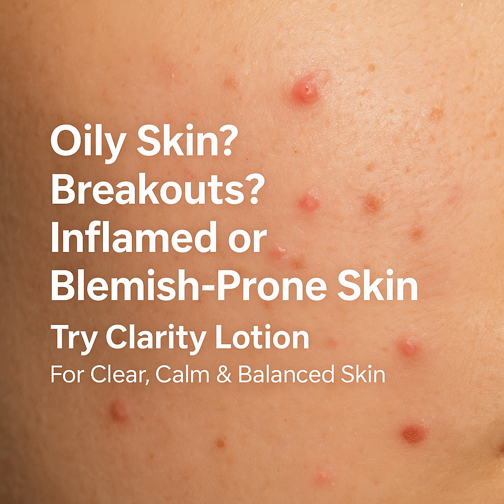 Oily skin breakouts. Inflammed skin image. Image of blemish prone skin. clarity lotion moisturizer for oily skin. 
