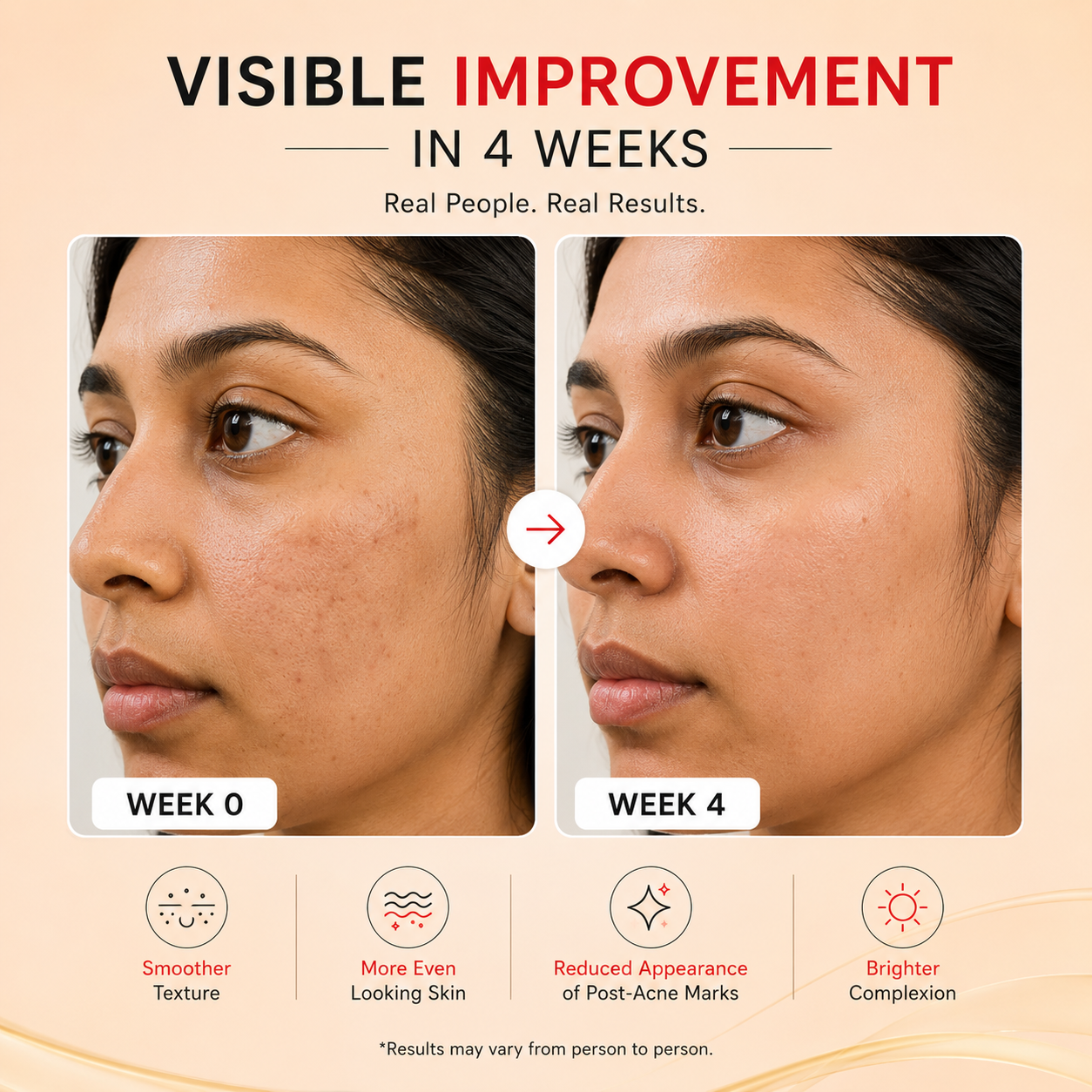 Before and after comparison of a woman's face with text indicating visible improvement in 4 weeks.