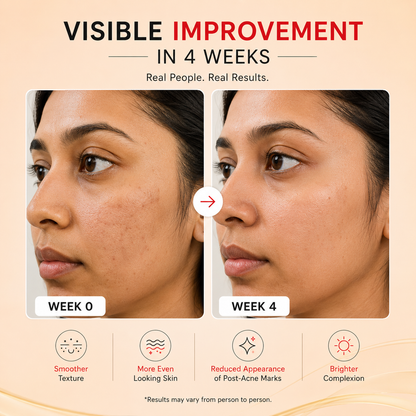 Before and after comparison of a woman's face with text indicating visible improvement in 4 weeks.