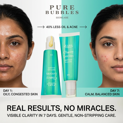 Pure Bubbles Skincare Clarity Lotion for Oily Acne Prone Skin, Lightweight Moisturizer for Men and Women